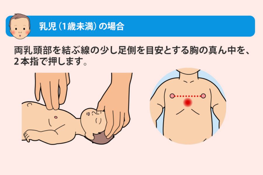 乳幼児の胸骨圧迫