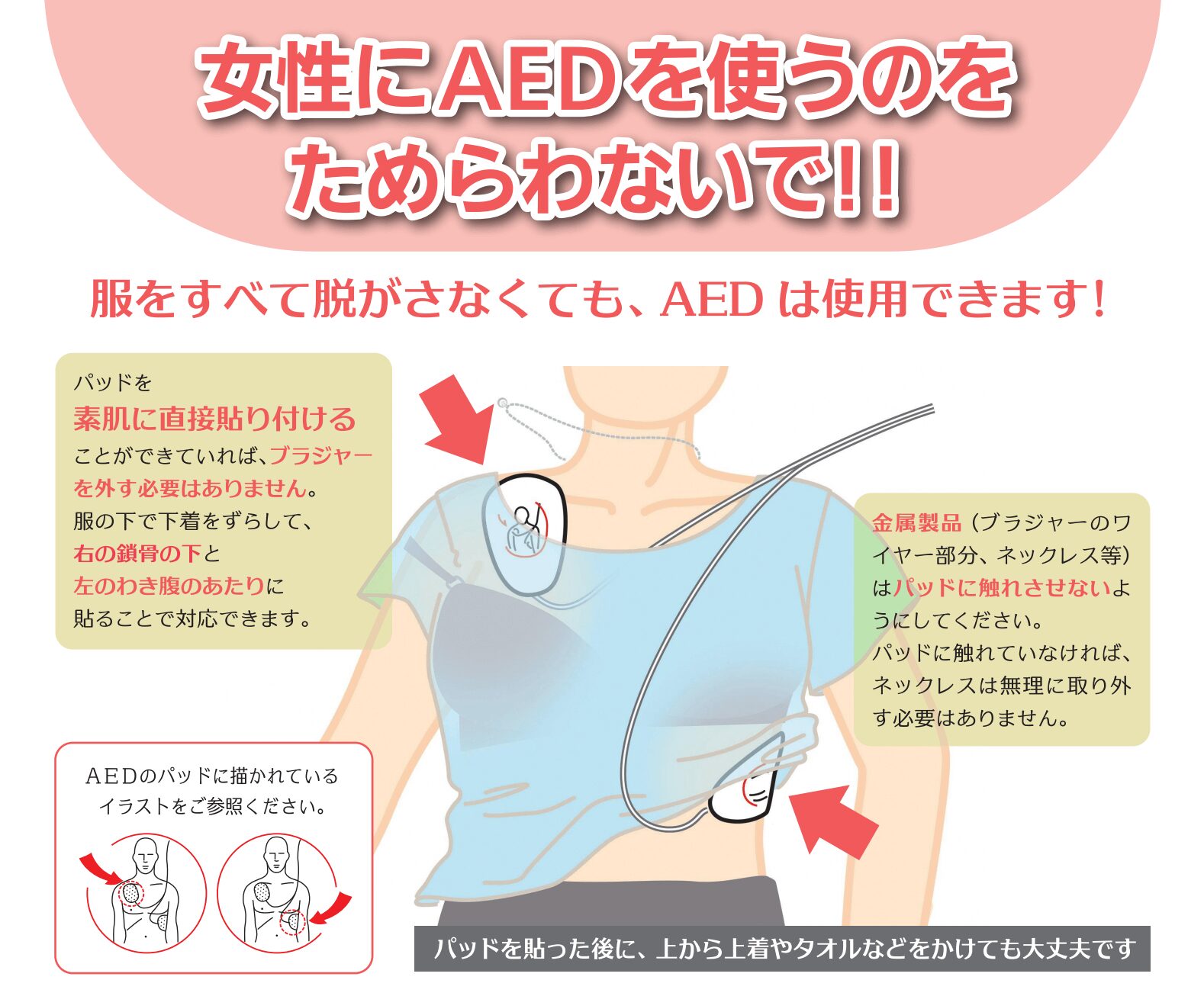 女性にAEDを使うときの貼り方